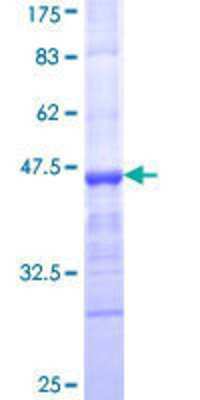 Unknown Recombinant Human MMRN1 GST (N-Term) Protein