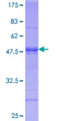 12.5% SDS-PAGE Stained with Coomassie Blue.