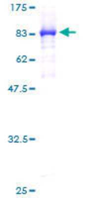 Other Recombinant Human CCT5 GST (N-Term) Protein