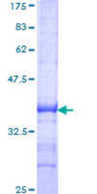 SDS-PAGE Recombinant Human SCMH1 GST (N-Term) Protein