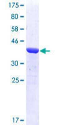 SDS-Page: Recombinant Human TPX2 Protein [H00022974-Q01] - 12.5% SDS-PAGE Stained with Coomassie Blue.