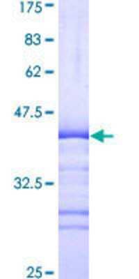 SDS-Page: Recombinant Human MAST1 Protein [H00022983-Q01] - 12.5% SDS-PAGE Stained with Coomassie Blue.