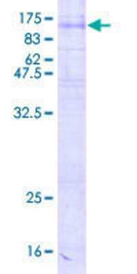 12.5% SDS-PAGE Stained with Coomassie Blue.