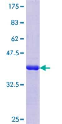 12.5% SDS-PAGE Stained with Coomassie Blue.