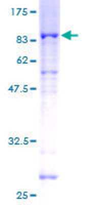 12.5% SDS-PAGE Stained with Coomassie Blue.