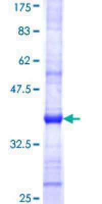 12.5% SDS-PAGE Stained with Coomassie Blue.