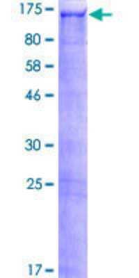 12.5% SDS-PAGE Stained with Coomassie Blue.