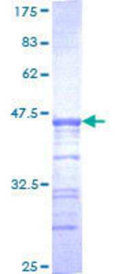 SDS-Page: Recombinant Human USP33 Protein [H00023032-Q01] - 12.5% SDS-PAGE Stained with Coomassie Blue.