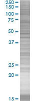 SAMD4A transfected lysate.