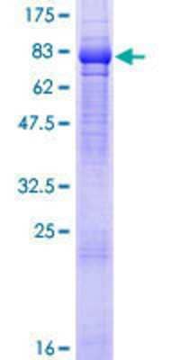 12.5% SDS-PAGE Stained with Coomassie Blue.