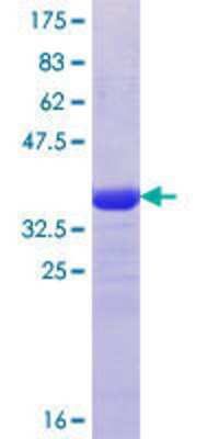 12.5% SDS-PAGE Stained with Coomassie Blue.