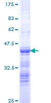 12.5% SDS-PAGE Stained with Coomassie Blue.