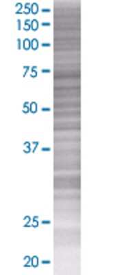 PDS5B transfected lysate.