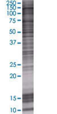 ZHX3 transfected lysate.