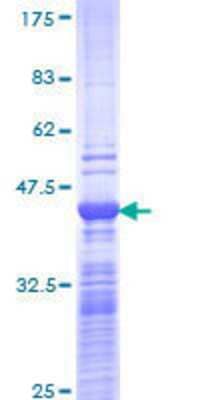 12.5% SDS-PAGE Stained with Coomassie Blue.