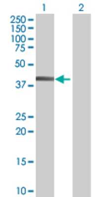 Lane 1: WAPAL transfected lysate (45.6 KDa) Lane 2: Non-transfected lysate.