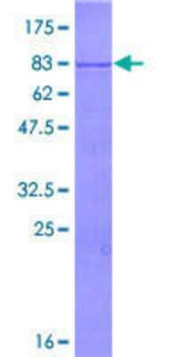 Other Recombinant Human TRIM35 GST (N-Term) Protein