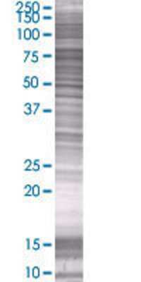 NCDN transfected lysate.