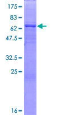 12.5% SDS-PAGE Stained with Coomassie Blue.
