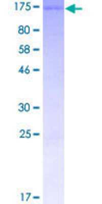 12.5% SDS-PAGE Stained with Coomassie Blue.