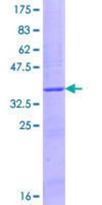 12.5% SDS-PAGE Stained with Coomassie Blue.