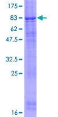12.5% SDS-PAGE Stained with Coomassie Blue.