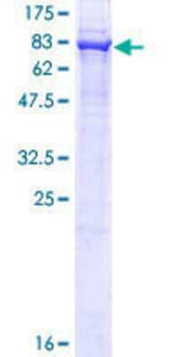 12.5% SDS-PAGE Stained with Coomassie Blue.