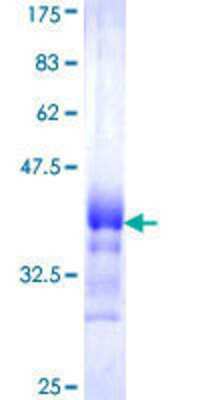 SDS-Page: Recombinant Human ATP11B Protein [H00023200-Q01] - 12.5% SDS-PAGE Stained with Coomassie Blue.