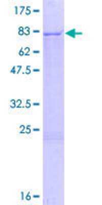 12.5% SDS-PAGE Stained with Coomassie Blue.
