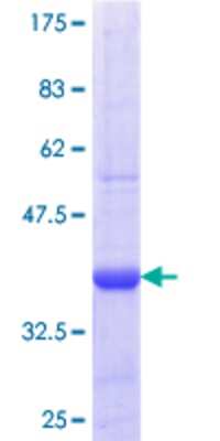 12.5% SDS-PAGE Stained with Coomassie Blue.
