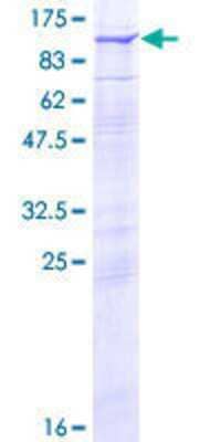 Other Recombinant Human RHOBTB2 GST (N-Term) Protein