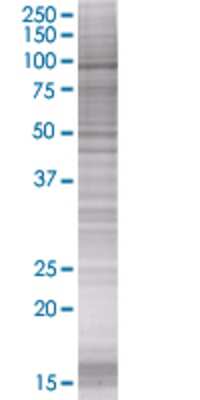 RHOBTB2 transfected lysate