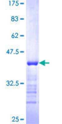 12.5% SDS-PAGE Stained with Coomassie Blue.