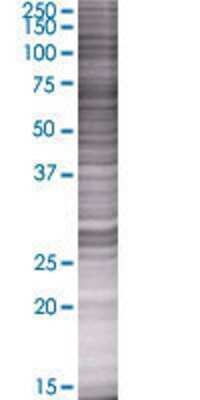 KIAA0460 transfected lysate.