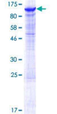 Other Recombinant Human DDHD2 GST (N-Term) Protein