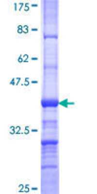 12.5% SDS-PAGE Stained with Coomassie Blue.