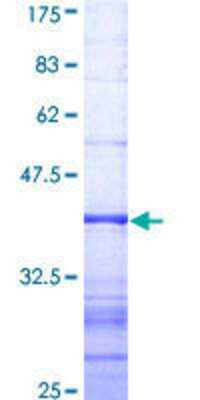 SDS-Page: Recombinant Human DNMBP Protein [H00023268-Q01] - 12.5% SDS-PAGE Stained with Coomassie Blue.