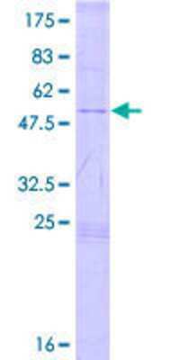 SDS-Page: Recombinant Human TSPYL4 Protein [H00023270-P01] - 12.5% SDS-PAGE Stained with Coomassie Blue.