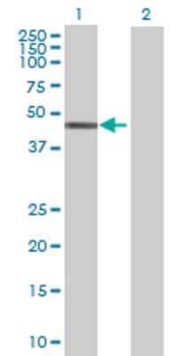 Lane 1: KIAA0774 transfected lysate (38.39 KDa) Lane 2: Non-transfected lysate.