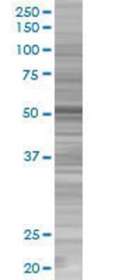 ANKS1 transfected lysate.