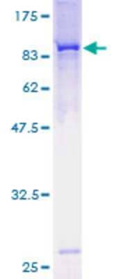 12.5% SDS-PAGE Stained with Coomassie Blue.