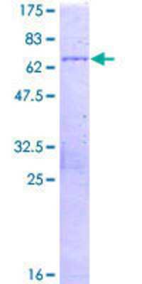 SDS-Page: Recombinant Human SMCHD1 Protein [H00023347-P01] - 12.5% SDS-PAGE Stained with Coomassie Blue.