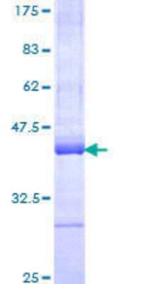 12.5% SDS-PAGE Stained with Coomassie Blue.