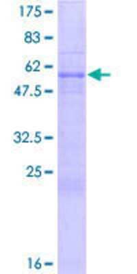 12.5% SDS-PAGE Stained with Coomassie Blue.