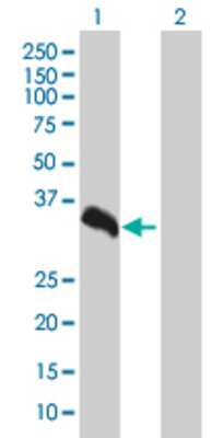 Lane 1: UNC84A transfected lysate (28.38 KDa). Lane 2: Non-transfected lysate.