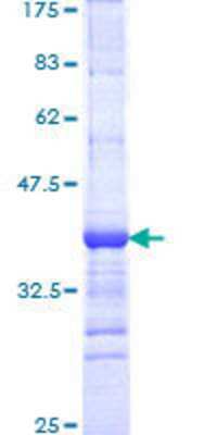 12.5% SDS-PAGE Stained with Coomassie Blue.