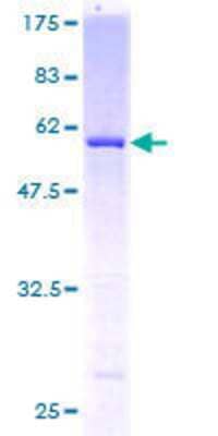 12.5% SDS-PAGE Stained with Coomassie Blue.