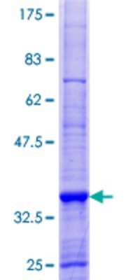 SDS-Page: Recombinant Human p114RhoGEF Protein [H00023370-P01] - 12.5% SDS-PAGE Stained with Coomassie Blue.