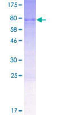 12.5% SDS-PAGE Stained with Coomassie Blue.