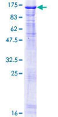 SDS-Page: Recombinant Human NCAPH Protein [H00023397-P01] - 12.5% SDS-PAGE Stained with Coomassie Blue.